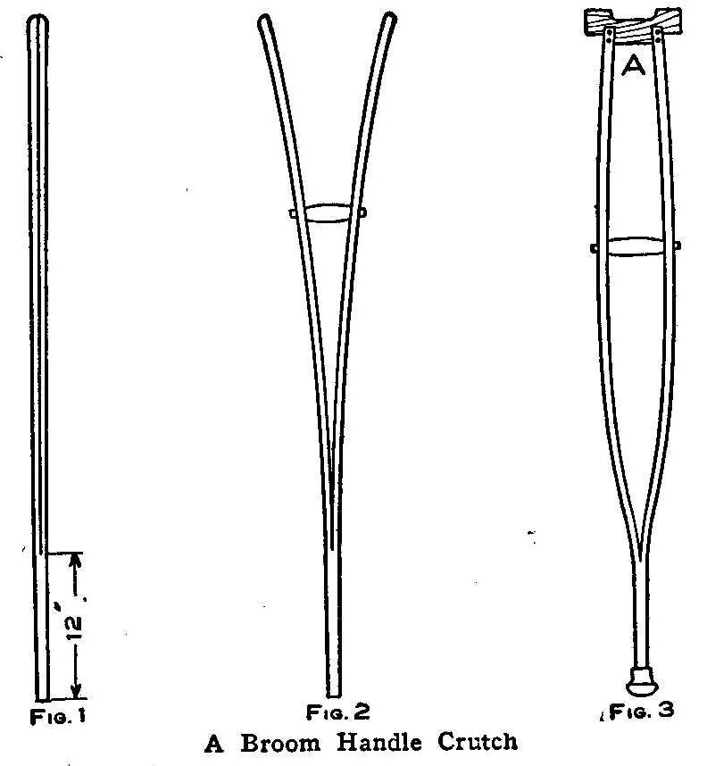 A Broom Handle Crutch