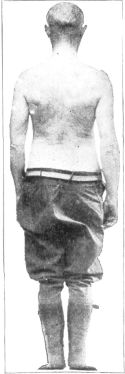 EFFECT OF THESE EXERCISES, SHOWING EVEN MUSCULAR
DEVELOPMENT
