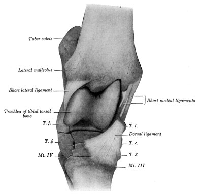 Fig. 54&mdash;Right hock joint. Viewed from the front and
slightly laterally after removal of joint capsule and long collateral
ligaments. T.t., Tibial tarsal bone (distal tuberosity). T.c., central
tarsal bone. T.3. Ridge of third tarsal bone. T.f. Fibular tarsal bone
(distal end). T.4. Fourth tarsal bone. Mt. III, Mt. IV. Metatarsal
bones. Arrow points to vascular canal. (From Sisson's ''Anatomy of the
Domestic Animals.'')