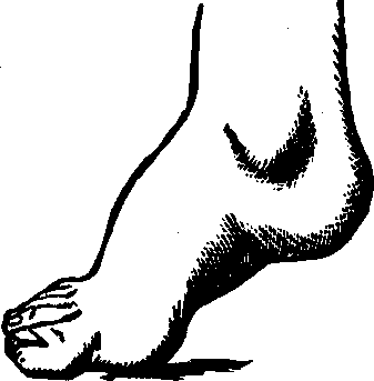 Illustration:
Fig. 18.