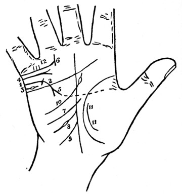 Plate XVIII. MARRIAGE LINES AND INFLUENCE LINES WHICH FURTHER HELP IN DENOTING
MARRIAGE.