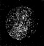 The contents of an ovum in an advanced stage of
segmentation.