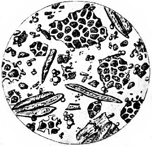 Ground Coffee Under the Microscope