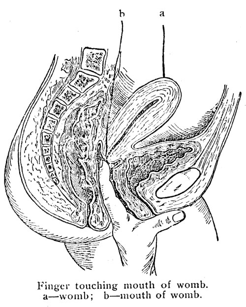 Finger touching mouth of womb.
a&mdash;womb; b&mdash;mouth of womb.
