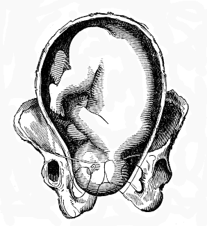  head
descended lower