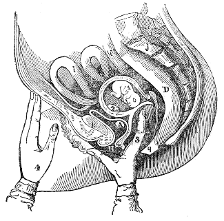 mode of
performing the Ballotment