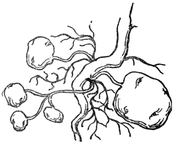 FIG. 8.&mdash;TUBERS OF THE COMMON POTATO

Potatoes are swollen portions of rootstock.